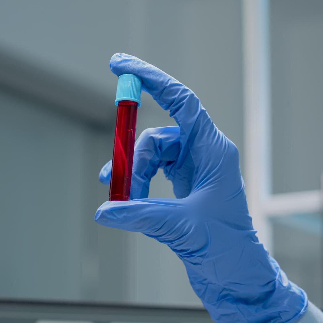 Hormone Replacement Therapy-dr-monica-grover-hrt