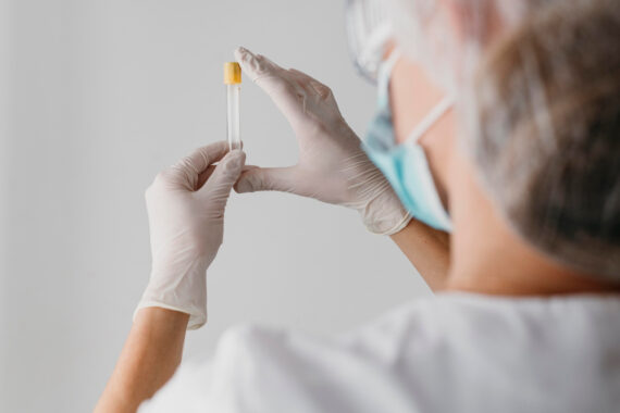 Boost Recovery and Performance: Peptide Therapy for Active Lifestyles