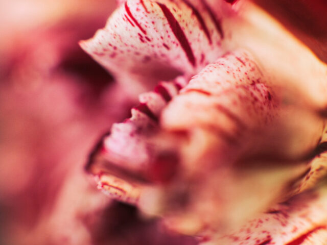 Labiaplasty in the Upper East Side: What to Expect from Manhattan’s Most Trusted Specialists