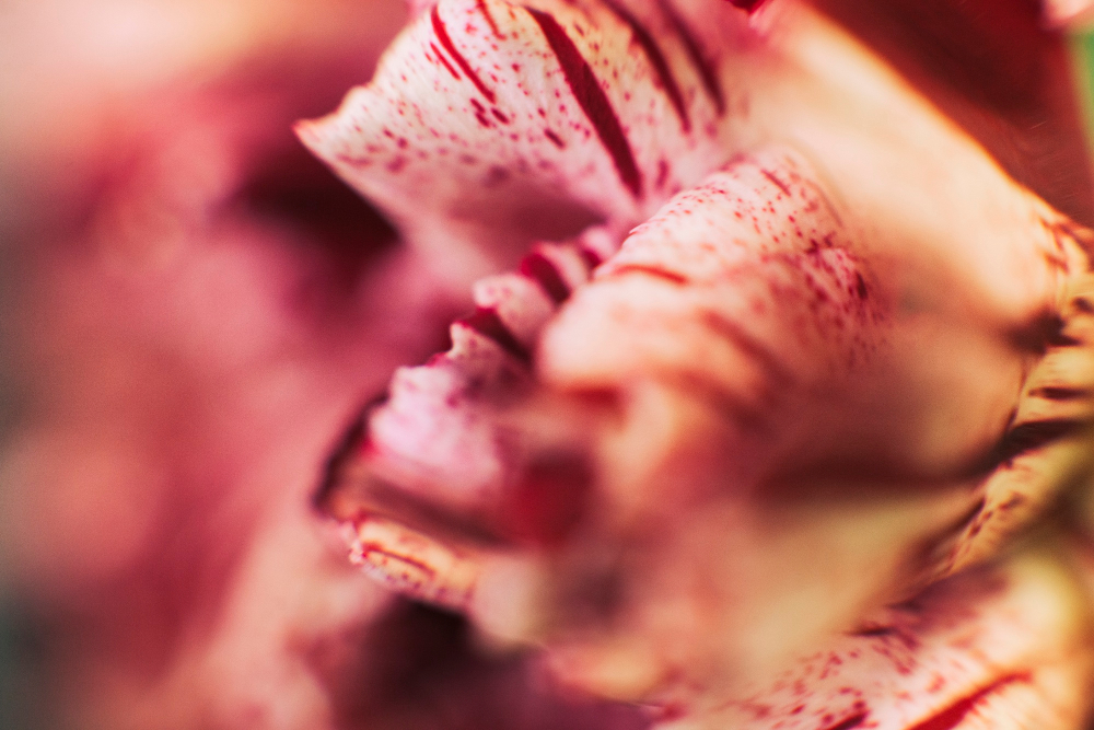 Labiaplasty in the Upper East Side: What to Expect from Manhattan’s Most Trusted Specialists