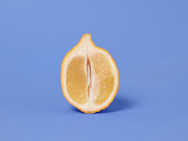 Choosing a Female-Focused Provider for Non-Surgical Labiaplasty in New York