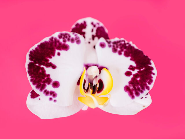 Is Labiaplasty Right for You? Signs It Might Be Time to Consider the Procedure