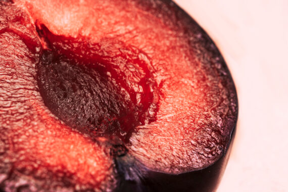 Inner Labia Concerns? Discover Non-Surgical Ways to Feel More Comfortable