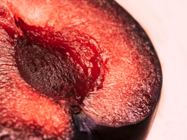 Inner Labia Concerns? Discover Non-Surgical Ways to Feel More Comfortable